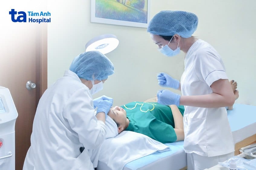 bac-si-bich-deo-kinh-ap-trong Bác sĩ Bích đang đeo kính áp tròng bằng sắt cho chị M. để thực hiện xóa nốt ruồi bằng laser CO2 Fractional