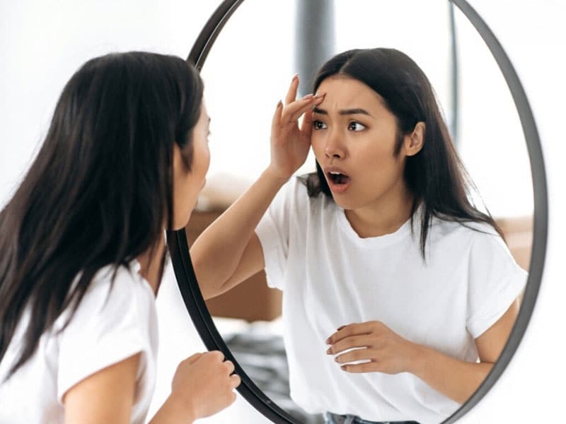 nguyen-nhan-khien-da-bi-sam-mau Nguyên nhân khiến da bị sẫm màu